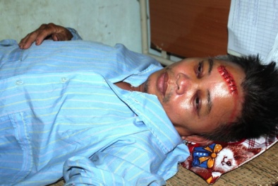 Công an bị côn đồ chém vào vỡ sọ